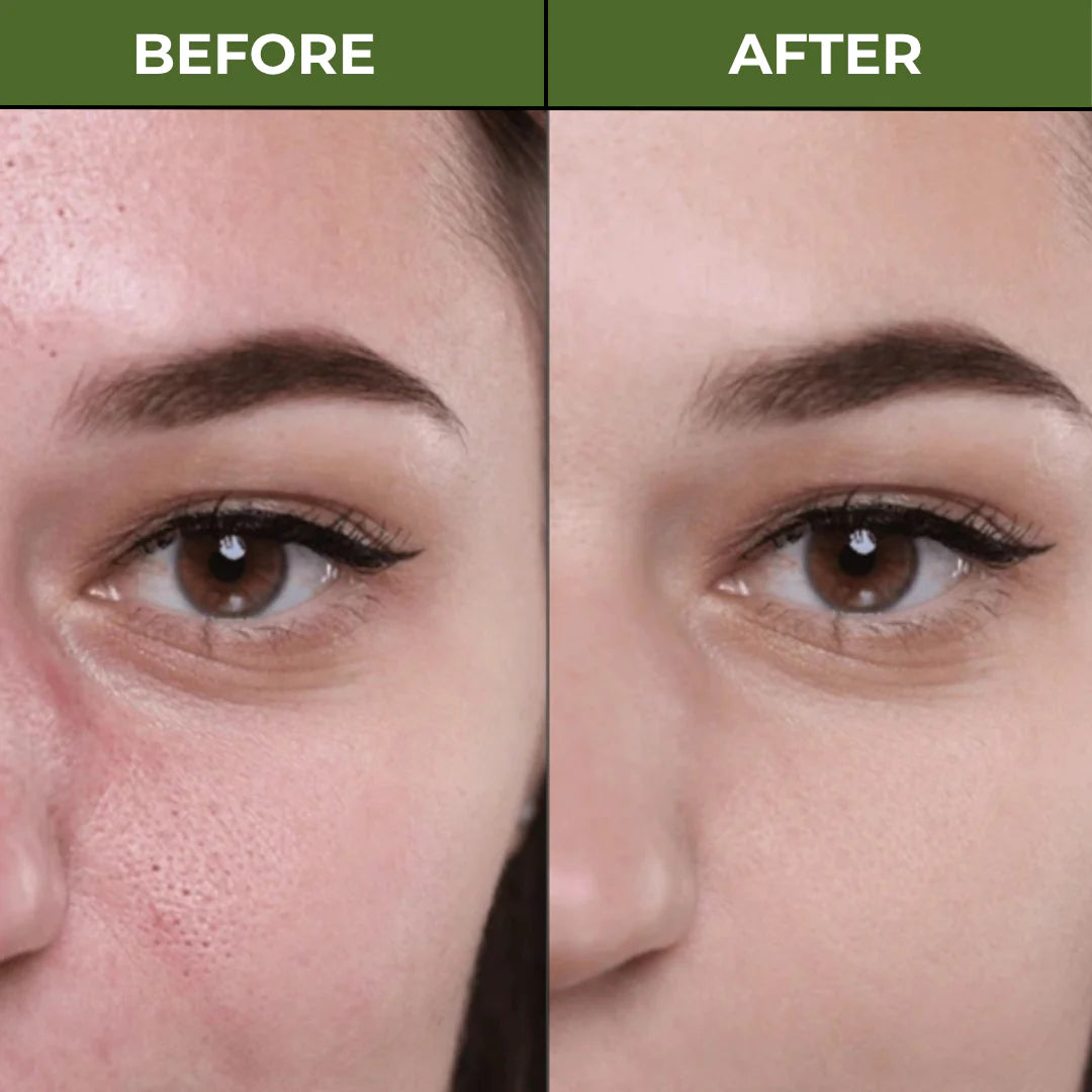 Holy Basil Deep Bubble Mask